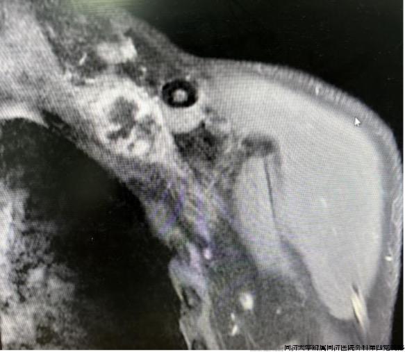 图片 1.jpg 图片 1.jpg